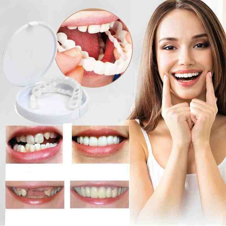 👨‍⚕Adjustable Snap-On Dentures😁100% non-inductive fit, no foreign body sensation！😁 (💥45% OFF) - 🔥HOT SALE🔥🎉